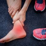 Ankle Sprain vs. Fracture