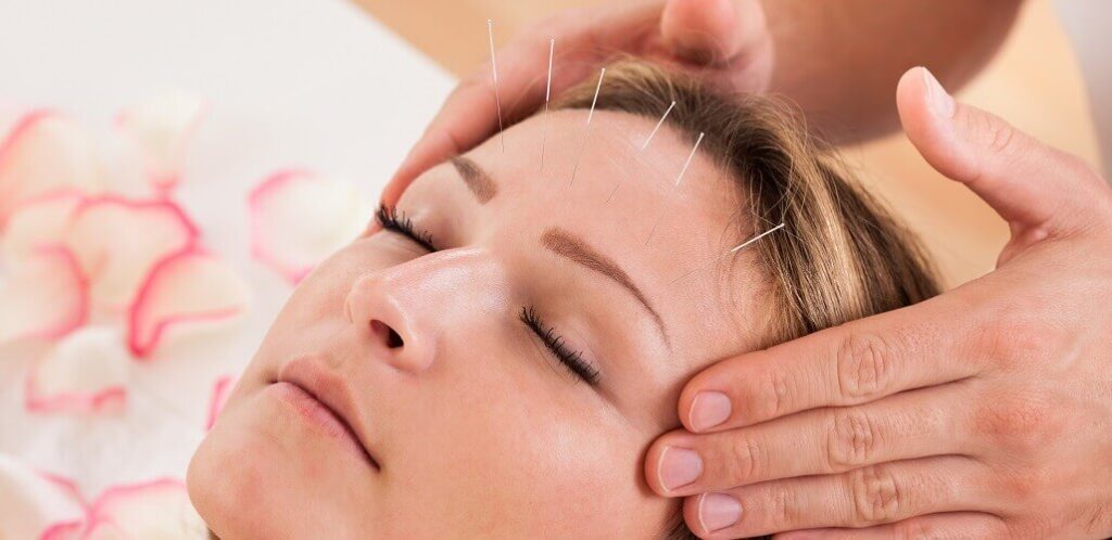 Acupuncture therapy Collingwood, ON